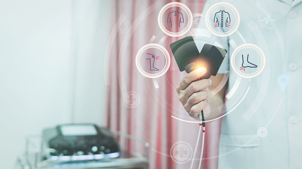 electrical nerve stimulation